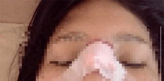 Una joven salió a buscar a un delincuente que le habría robado la moto y le quebraron la nariz