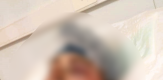 Brutal agresión en Colón: Joven internada en terapia intensiva tras salvaje ataque