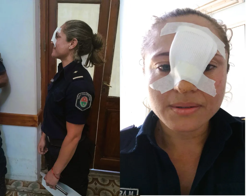 Una mujer agredió y fracturó la nariz de una subcomisaria durante un altercado en el refugio municipal