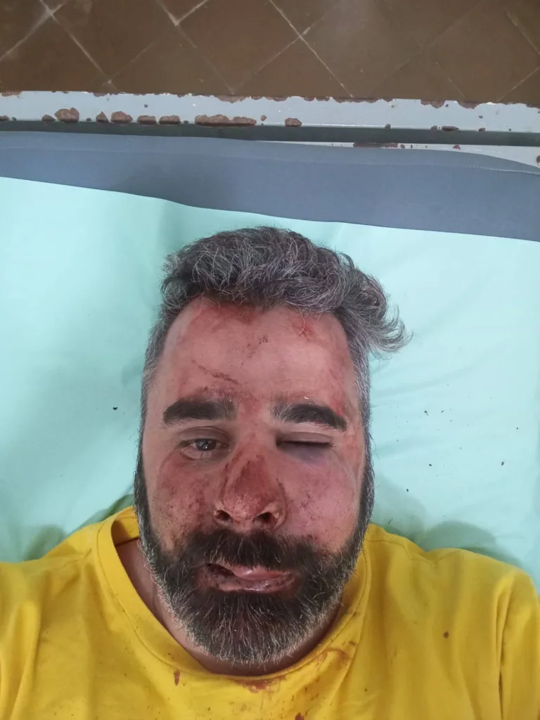 Violento ataque contra el presidente del Partido Libertario en San José