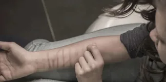 La importancia de detectar y abordar los cortes superficiales autoinfligidos